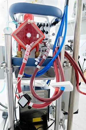 Extracorporeal Membrane Oxygenation (ECMO) Machine